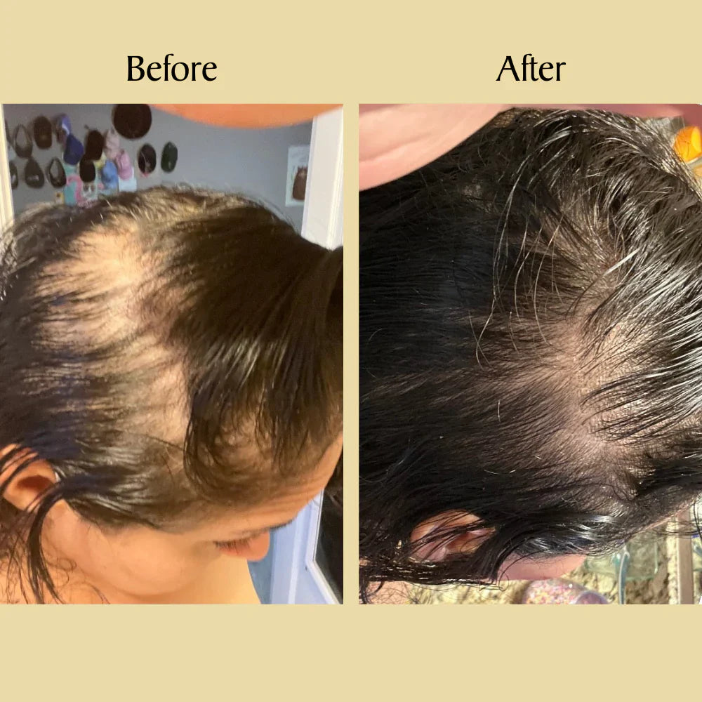Amahle Natural Hair Growth Oil - GROW YOUR HAIR OR GET YOUR MONEY BACK