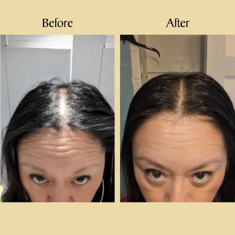 Amahle Natural Hair Growth Oil - GROW YOUR HAIR OR GET YOUR MONEY BACK